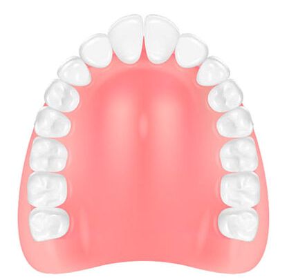 コンフォート義歯イラスト