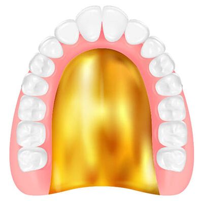 ゴールド床義歯イラスト