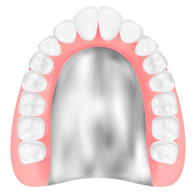 コバルトクロム床義歯イラスト