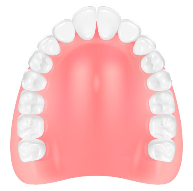 レジン床義歯イラスト