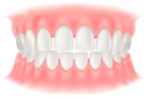 すきっ歯(空隙歯列:くうげきしれつ)のイラスト