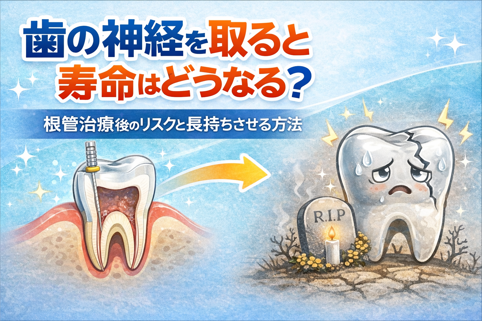 歯の神経を取ると寿命はどうなる?根管治療後のリスクと長持ちさせる方法